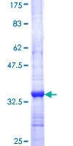 Novus Biologicals Recombinant Human AP1M1 GST (N-Term) Protein 25 &mu;g | Buy Online | Novus Biologicals&trade; | Fisher Scientific