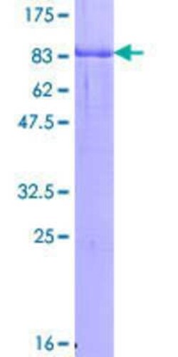 Novus Biologicals Recombinant Human GYG2 GST (N-Term) Protein 10 &mu;g | Buy Online | Novus Biologicals&trade; | Fisher Scientific