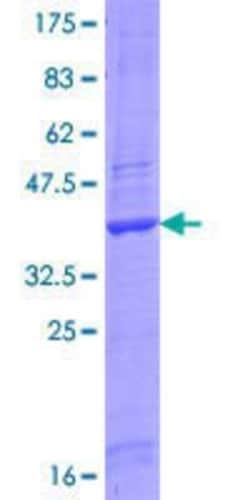 Novus Biologicals Recombinant Human P11 GST (N-Term) Protein 25 &mu;g | Buy Online | Novus Biologicals&trade; | Fisher Scientific