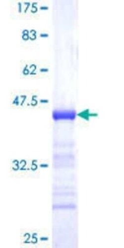Novus Biologicals Recombinant Human Timeless GST (N-Term) Protein 10 &mu;g | Buy Online | Novus Biologicals&trade; | Fisher Scientific