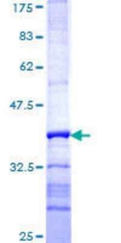 Novus Biologicals Recombinant Human HERC3 GST (N-Term) Protein 10 &mu;g | Buy Online | Novus Biologicals&trade; | Fisher Scientific