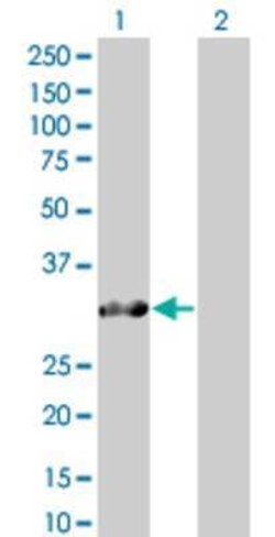 Novus Biologicals SNURF 293T Cell Transient Overexpression Lysate 0.1 mL | Buy Online | Novus Biologicals&trade; | Fisher Scientific