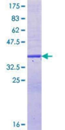Novus Biologicals Recombinant Human MBD4 GST (N-Term) Protein 25 &mu;g | Buy Online | Novus Biologicals&trade; | Fisher Scientific