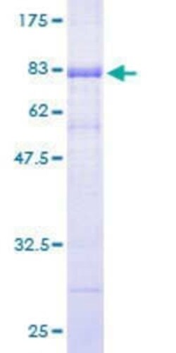Novus Biologicals Recombinant Human SCAP2 GST (N-Term) Protein 10 &mu;g | Buy Online | Novus Biologicals&trade; | Fisher Scientific