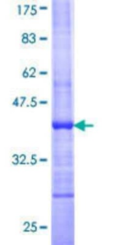 Novus Biologicals Recombinant Human BAIAP3 GST (N-Term) Protein 25 &mu;g | Buy Online | Novus Biologicals&trade; | Fisher Scientific
