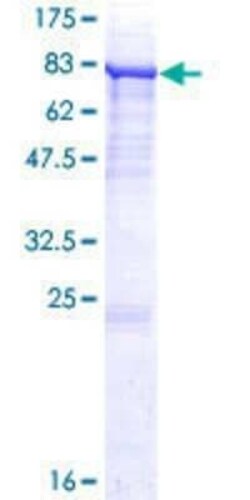 Novus Biologicals Recombinant Human P4HA2 GST (N-Term) Protein 25 &mu;g | Buy Online | Novus Biologicals&trade; | Fisher Scientific