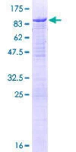Novus Biologicals Recombinant Human N-WASP GST (N-Term) Protein 25 &mu;g | Buy Online | Novus Biologicals&trade; | Fisher Scientific