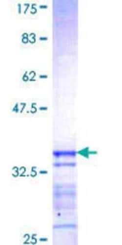 Novus Biologicals Recombinant Human N-WASP GST (N-Term) Protein 2 &mu;g | Buy Online | Novus Biologicals&trade; | Fisher Scientific