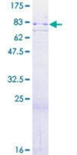 Novus Biologicals Recombinant Human MSK2 GST (N-Term) Protein 2 &mu;g | Buy Online | Novus Biologicals&trade; | Fisher Scientific