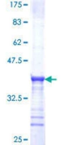 Novus Biologicals Recombinant Human TRPA1 GST (N-Term) Protein 25 &mu;g | Buy Online | Novus Biologicals&trade; | Fisher Scientific