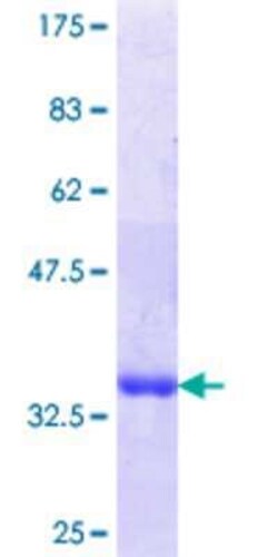 Novus Biologicals Recombinant Human LIMD1 GST (N-Term) Protein 10 &mu;g | Buy Online | Novus Biologicals&trade; | Fisher Scientific