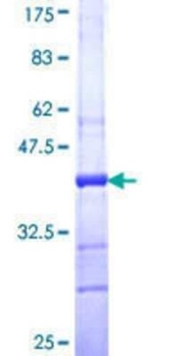 Novus Biologicals Recombinant Human KALRN GST (N-Term) Protein 10 &mu;g | Buy Online | Novus Biologicals&trade; | Fisher Scientific