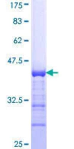Novus Biologicals Recombinant Human CDKL2 GST (N-Term) Protein 10 &mu;g | Buy Online | Novus Biologicals&trade; | Fisher Scientific