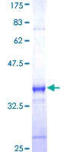 Novus Biologicals Recombinant Human PAR4 GST (N-Term) Protein 10 &mu;g | Buy Online | Novus Biologicals&trade; | Fisher Scientific