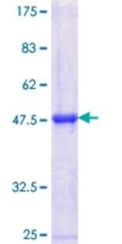 Novus Biologicals Recombinant Human TAF1C GST (N-Term) Protein 10 &mu;g | Buy Online | Novus Biologicals&trade; | Fisher Scientific