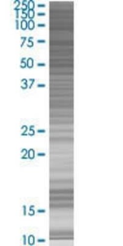 Novus Biologicals TAF1C 293T Cell Transient Overexpression Lysate 0.1 mL | Buy Online | Novus Biologicals&trade; | Fisher Scientific