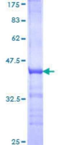 Novus Biologicals Recombinant Human TAF148 GST (N-Term) Protein 10 &mu;g | Buy Online | Novus Biologicals&trade; | Fisher Scientific
