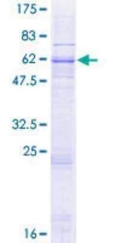 Novus Biologicals Recombinant Human UCP5 GST (N-Term) Protein 2 &mu;g | Buy Online | Novus Biologicals&trade; | Fisher Scientific