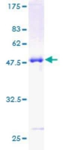 Novus Biologicals Recombinant Human CLIC3 GST (N-Term) Protein 10 &mu;g | Buy Online | Novus Biologicals&trade; | Fisher Scientific