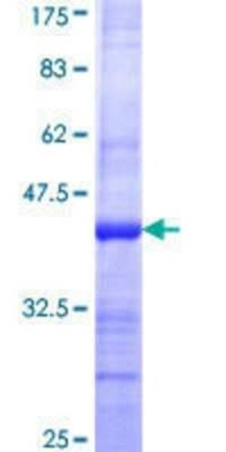 Novus Biologicals Recombinant Human CLIC3 GST (N-Term) Protein 10 &mu;g | Buy Online | Novus Biologicals&trade; | Fisher Scientific