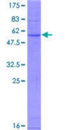 Novus Biologicals Recombinant Human CH25H GST (N-Term) Protein 10 &mu;g | Buy Online | Novus Biologicals&trade; | Fisher Scientific
