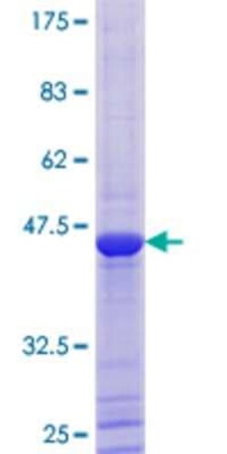 Novus Biologicals&trade;&nbsp;Recombinant Human BRSK2 GST (N-Term) Protein