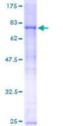 Novus Biologicals Recombinant Human RNF8 GST (N-Term) Protein 25 &mu;g | Buy Online | Novus Biologicals&trade; | Fisher Scientific