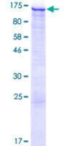 Novus Biologicals Recombinant Human HIP1 Related GST (N-Term) Protein 25 &mu;g | Buy Online | Novus Biologicals&trade; | Fisher Scientific