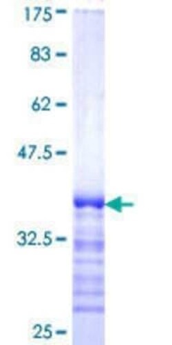 Novus Biologicals Recombinant Human HIP1 Related GST (N-Term) Protein 10 &mu;g | Buy Online | Novus Biologicals&trade; | Fisher Scientific