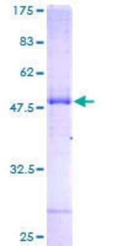 Novus Biologicals Recombinant Human NAT8 GST (N-Term) Protein 25 &mu;g | Buy Online | Novus Biologicals&trade; | Fisher Scientific