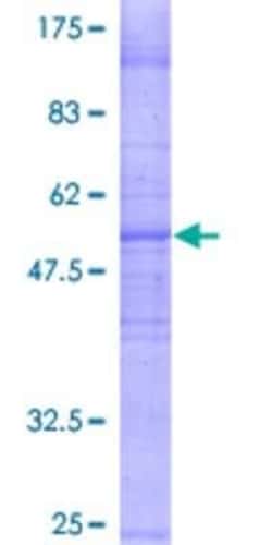 Novus Biologicals Recombinant Human PKD2L1 GST (N-Term) Protein 25 &mu;g | Buy Online | Novus Biologicals&trade; | Fisher Scientific