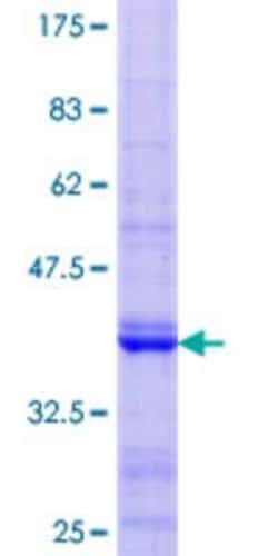 Novus Biologicals Recombinant Human PKD2L1 GST (N-Term) Protein 25 &mu;g | Buy Online | Novus Biologicals&trade; | Fisher Scientific