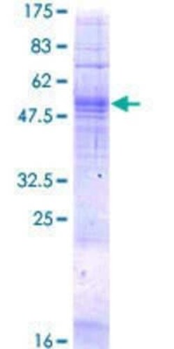 Novus Biologicals Recombinant Human TAAR5 GST (N-Term) Protein 2 &mu;g | Buy Online | Novus Biologicals&trade; | Fisher Scientific