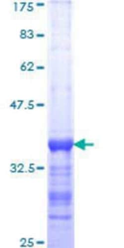 Novus Biologicals Recombinant Human BTAF1 GST (N-Term) Protein 10 &mu;g | Buy Online | Novus Biologicals&trade; | Fisher Scientific