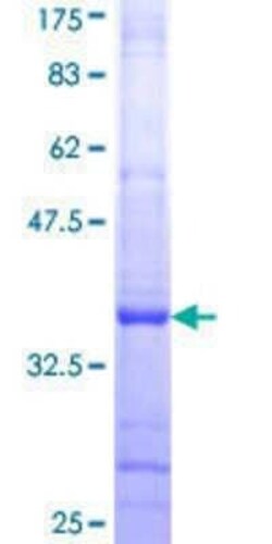 Novus Biologicals Recombinant Human RPL14 GST (N-Term) Protein 2 &mu;g | Buy Online | Novus Biologicals&trade; | Fisher Scientific