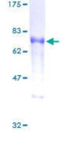 Novus Biologicals Recombinant Human DOK2 GST (N-Term) Protein 10 &mu;g | Buy Online | Novus Biologicals&trade; | Fisher Scientific