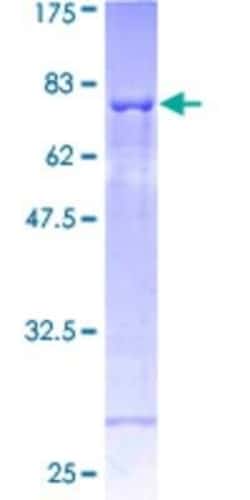 Novus Biologicals Recombinant Human SH2D2A GST (N-Term) Protein 10 &mu;g | Buy Online | Novus Biologicals&trade; | Fisher Scientific