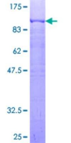 Novus Biologicals Recombinant Human PRC1 GST (N-Term) Protein 2 &mu;g | Buy Online | Novus Biologicals&trade; | Fisher Scientific