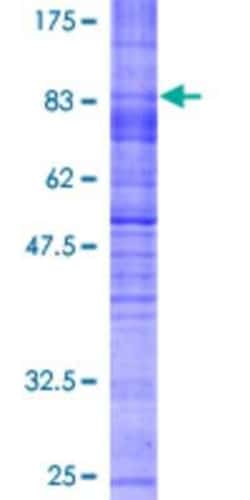 Novus Biologicals™ Recombinant Human SLC7A7 GST (N-Term) Protein