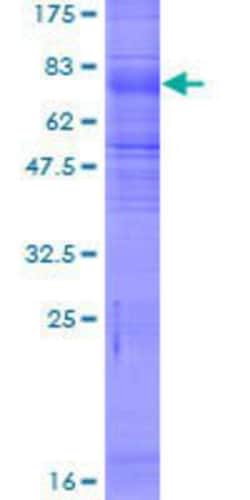 Novus Biologicals™ Recombinant Human SLC7A7 GST (N-Term) Protein