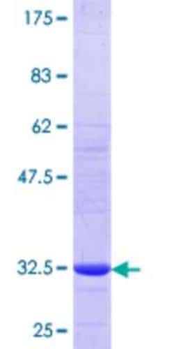 Novus Biologicals™ Recombinant Human SLC7A7 GST (N-Term) Protein