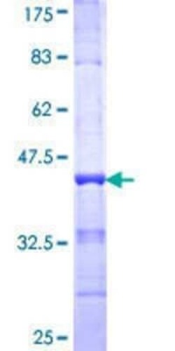 Novus Biologicals™ Recombinant Human PAPSS2 GST (N-Term) Protein