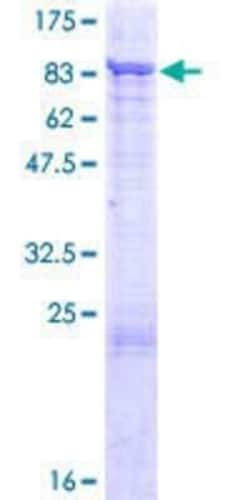 Novus Biologicals Recombinant Human PIAS2 GST (N-Term) Protein 2 &mu;g | Buy Online | Novus Biologicals&trade; | Fisher Scientific