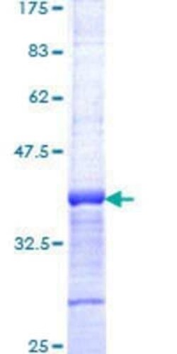 Novus Biologicals Recombinant Human PIAS2 GST (N-Term) Protein 10 &mu;g | Buy Online | Novus Biologicals&trade; | Fisher Scientific