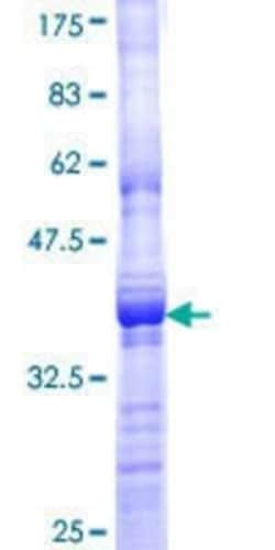 Novus Biologicals Recombinant Human MAP3K6 GST (N-Term) Protein 25 &mu;g | Buy Online | Novus Biologicals&trade; | Fisher Scientific
