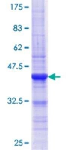Novus Biologicals Recombinant Human ASH2L GST (N-Term) Protein 10 &mu;g | Buy Online | Novus Biologicals&trade; | Fisher Scientific