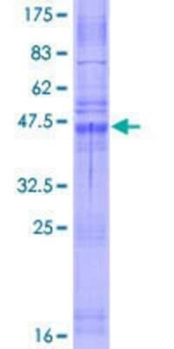 Novus Biologicals Recombinant Human Claudin 10 GST (N-Term) Protein 2 &mu;g | Buy Online | Novus Biologicals&trade; | Fisher Scientific