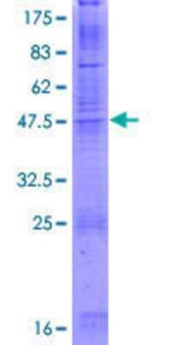Novus Biologicals Recombinant Human Claudin-8 GST (N-Term) Protein 2 &mu;g | Buy Online | Novus Biologicals&trade; | Fisher Scientific