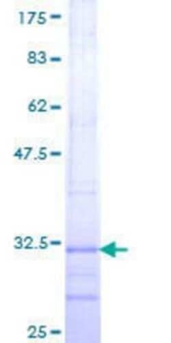 Novus Biologicals Recombinant Human Claudin-8 GST (N-Term) Protein 10 &mu;g | Buy Online | Novus Biologicals&trade; | Fisher Scientific