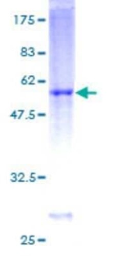 Novus Biologicals Recombinant Human DIRAS3 GST (N-Term) Protein 2 &mu;g | Buy Online | Novus Biologicals&trade; | Fisher Scientific